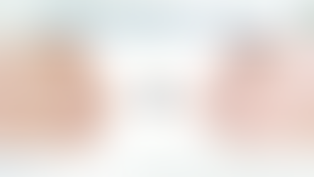 ศัลยกรรมจมูกทรงบาร์บี้ไลน์ จมูกเดิมมาทรงไหนก็รอด! ที่โรงพยาบาลไอดี