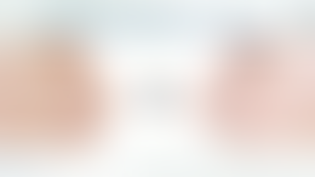 ศัลยกรรมจมูกทรงบาร์บี้ไลน์ จมูกเดิมมาทรงไหนก็รอด! ที่โรงพยาบาลไอดี