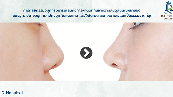 ศัลยกรรมจมูกทรงบาร์บี้ไลน์ จมูกเดิมมาทรงไหนก็รอด! ที่โรงพยาบาลไอดี