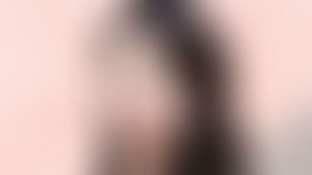 ศัลยกรรมลดโหนกแก้ม MAX-L