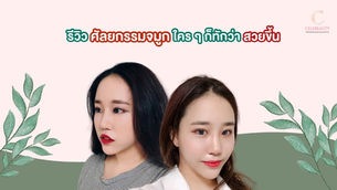 รีวิว ศัลยกรรมจมูก ที่นานะ