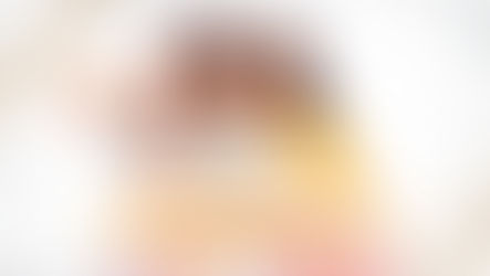 การศัลยกรรมลดความยาวร่องเหนือริมฝีปาก