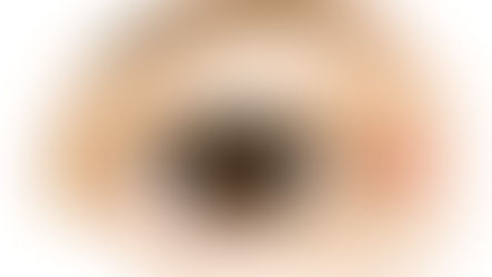 ศัลยกรรมเปิดหางตาคืออะไร?