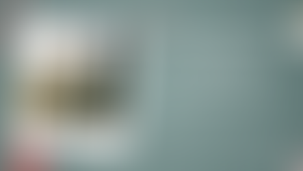 ศัลยกรรมจมูกของผู้ชาย แบบ open+close,@Banobagi Plastic Surgery,