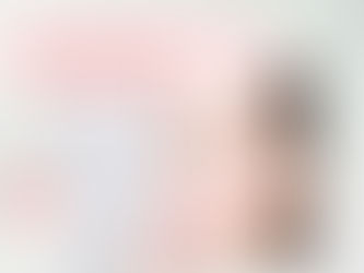 ศัลยกรรมแก้จมูกยาวงอ(จมูกคันธนู)