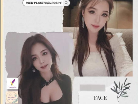 Real Review ปรับโครงหน้าแบบ DOLL LINE โครงหน้าเรียวเล็กน่ารักแบบตุ๊กตา