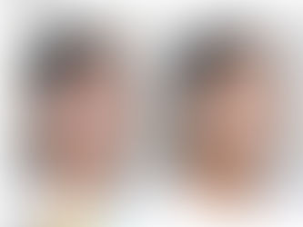 ผ่าตัดขากรรไกร โครงหน้า3จุด