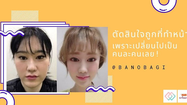 รีวิว ศัลยกรรมผ่าโครงหน้า ตัดสินใจถูกที่ทำหน้า เพราะเปลี่ยนไปเป็นคนละคน! (ตอนที่ 1)