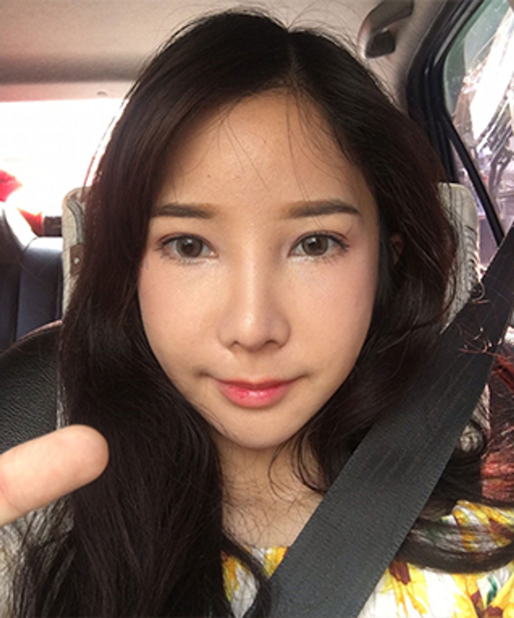 리얼스토리 사진, 지앤지병원 후기 - 지앤지병원