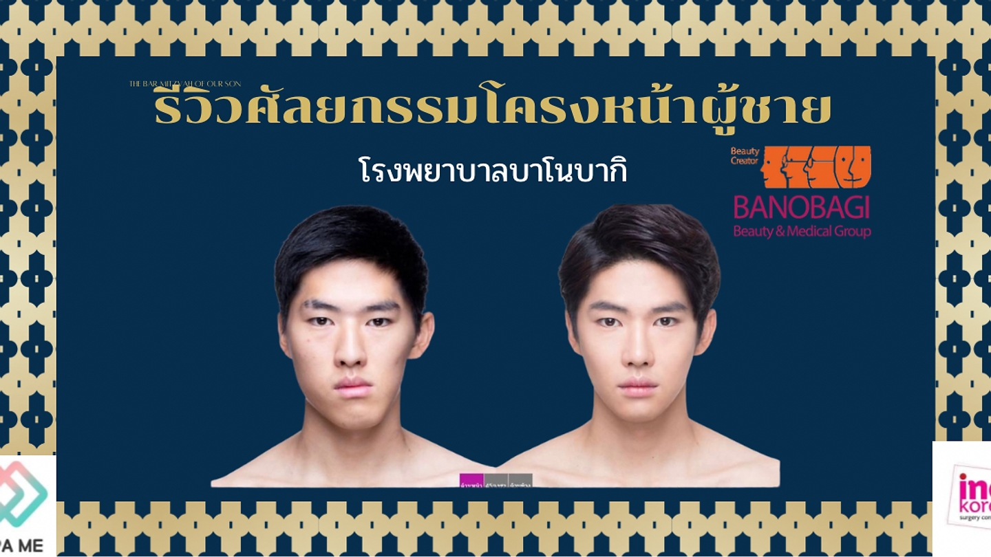 รีวิวศัลยกรรมโครงหน้าผู้ชาย ใบหน้าไม่เท่ากัน ก็แก้ไขได้ที่โรงพยาบาลบาโนบากิ (ตอนที่ 1)