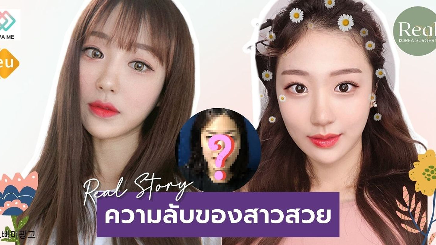 Real Story ใบหน้าไม่สมมาตร ถูกแก้ไขด้วยฝีมือคุณหมอชิน แห่งโรงพยาบาล EU (ตอนที่ 1)