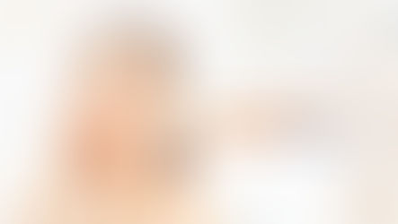 ศัลยกรรมจมูก โดยไม่ใช้ซิลิโคน