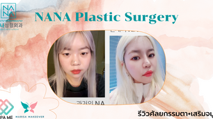 รีวิวศัลยกรรมตา+เสริมจมูก