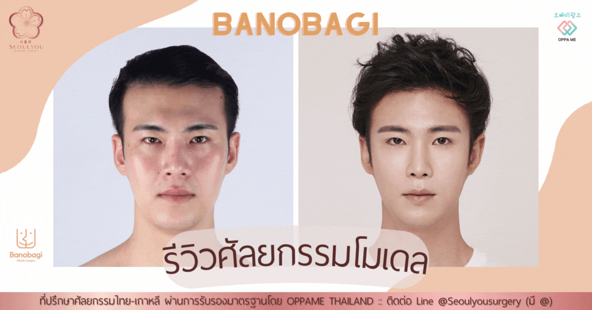 รีวิวศัลยกรรมโมเดลผู้ชาย โรงพยาบาลบาโนบากิ (ตอนที่ 1)