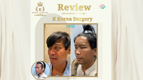 รีวิว ดึงหน้า ศัลยกรรมเกาหลี อยากหน้าเด็ก แผลสวย ๆ ต้องที่นี่เท่านั้น !!! (ตอนที่ 1)