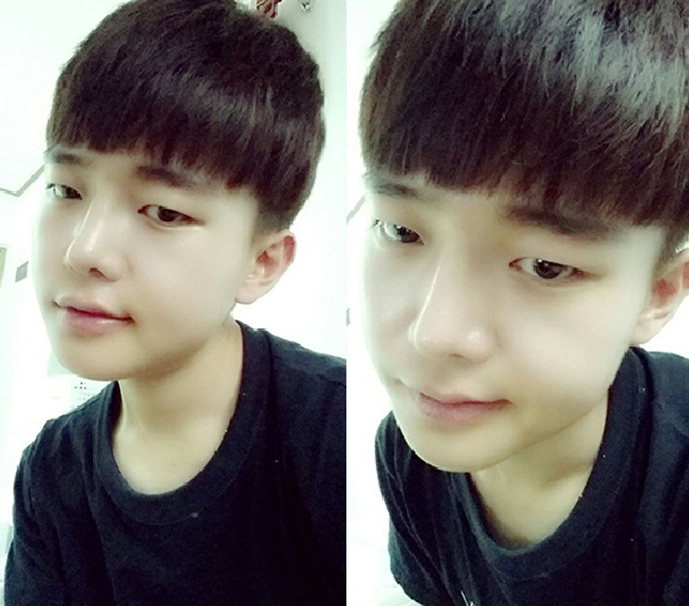 리얼스토리 사진, 지앤지병원 후기 - 지앤지병원