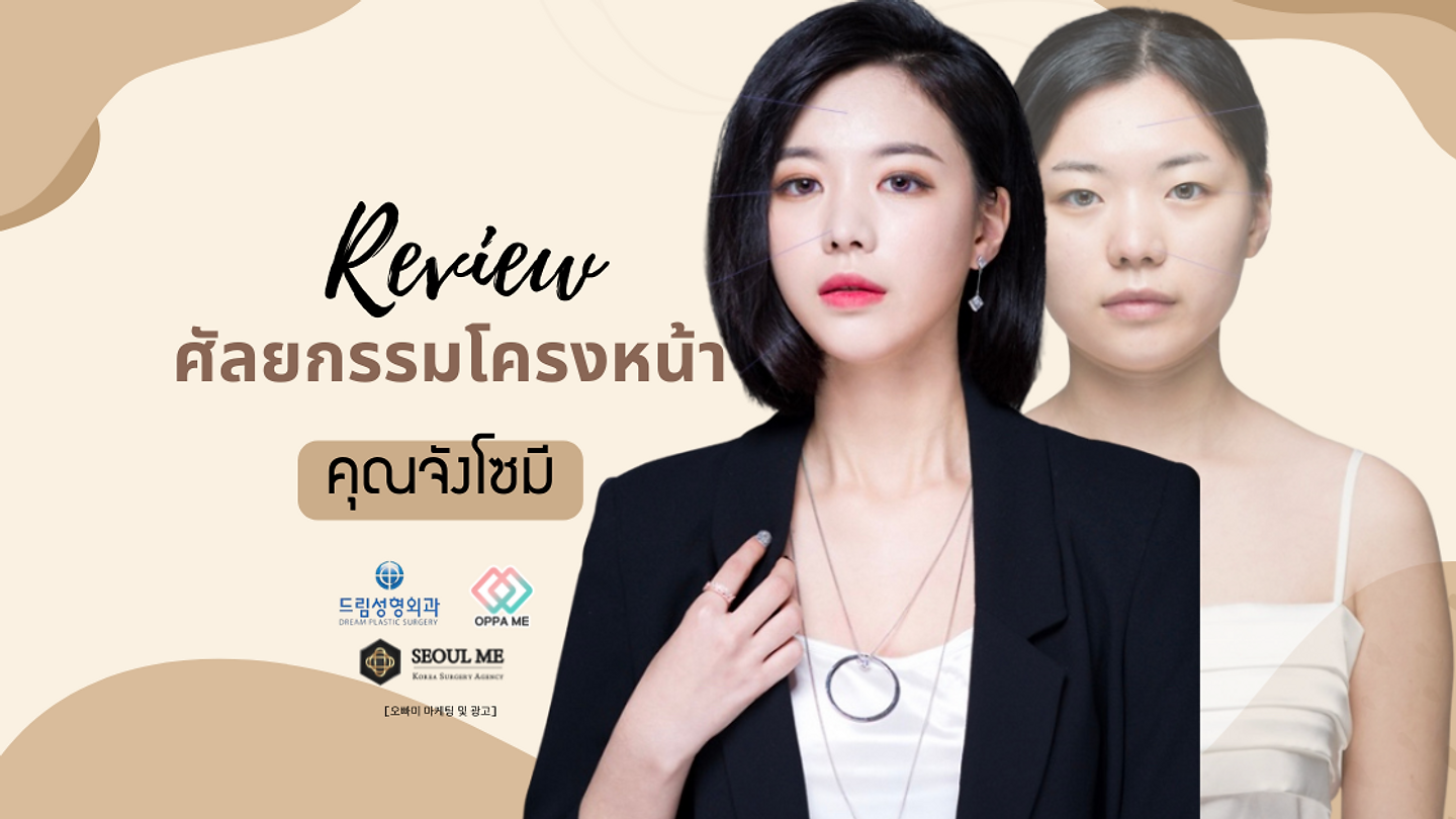 รีวิวศัลยกรรมโครงหน้าคุณจังโซมี (ตอนที่ 2)