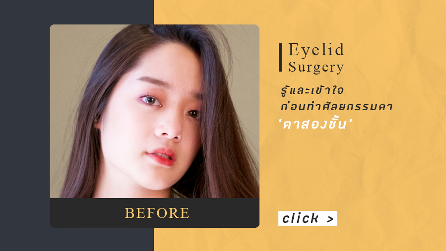 รู้และเข้าใจก่อนทำตาสองชั้น (ตอนที่ 1)
