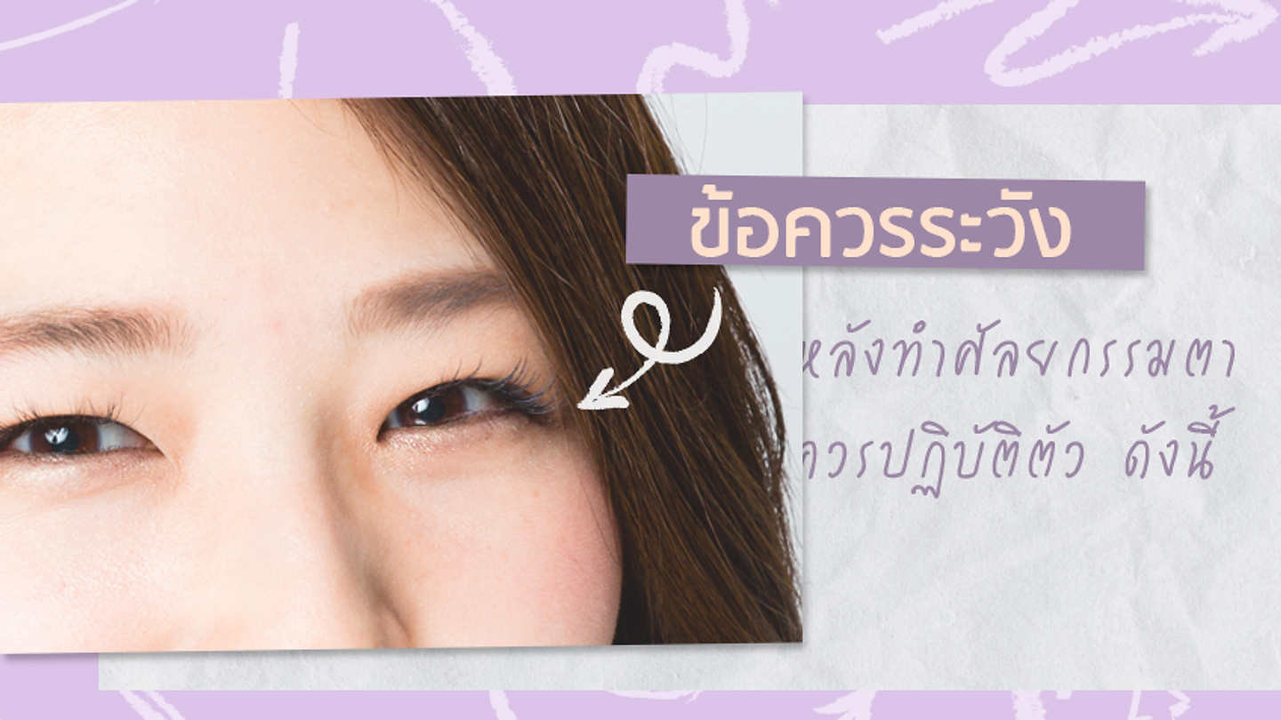 การดูแล และ ข้อควรระวัง หลังทำศัลยกรรมตา (ตอนที่ 1)