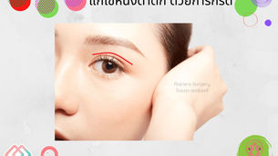 แก้ไขหนังตาตก ด้วยการกรีด @Atop Plastic Surgery