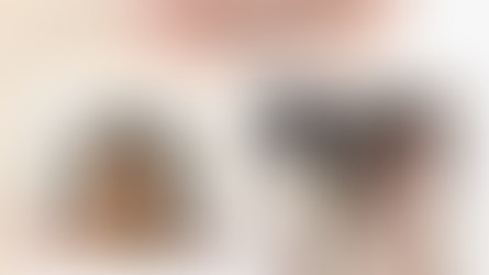 รีวิวศัลยกรรม แก้ตาสองชั้น(เปิดตา3จุด) + แก้จมูกแบบฟลูออฟชั่น + เติมไขมันหน้า