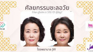 รีวิวศัลยกรรมยกกระชับชะลอวัย SMAS Lifting โรงพยาบาล JW