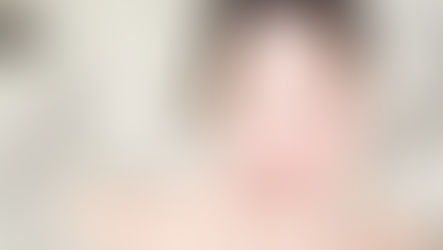 ศัลยกรรมยกคิ้ว