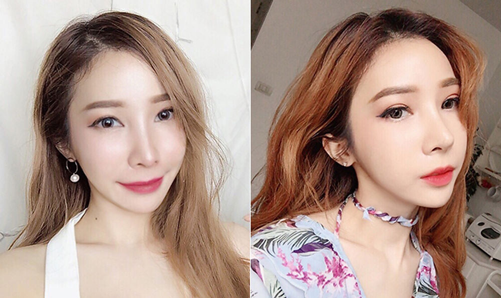 리얼스토리 사진, 지앤지병원 후기 - 지앤지병원