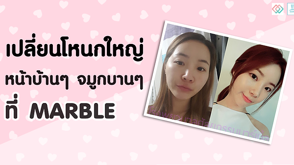 เปลี่ยนสาวโหนกใหญ่ หน้าบ้านๆ จมูกบานๆ ให้หวานขึ้นอีกนิด ที่ Marble (ตอนที่ 1)