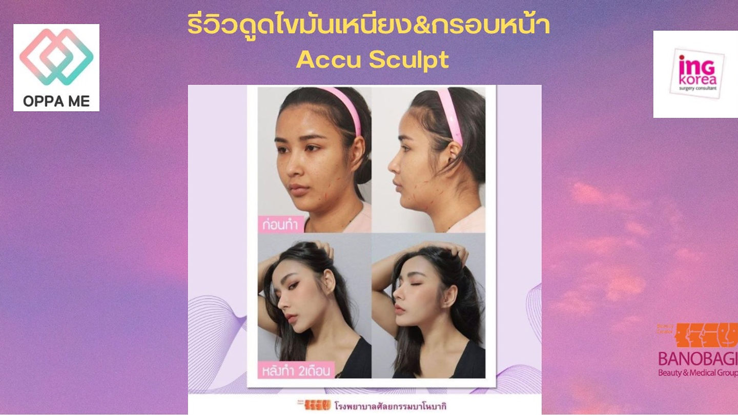 รีวิวดูดไขมันเหนียงและกรอบหน้า Accu Sculpt โรงพยาบาลบาโนบากิ (ตอนที่ 1)