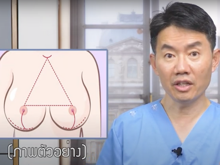 ยกกระชับหน้าอก หน้าอกหย่อน?