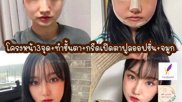 Real Review ต๊าชชชไม่หยุด สาวหมวยเป็นหมวยแบบแซ่บๆ ที่ รพ.วิว (ตอนที่ 2)