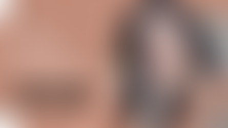 รีวิวศัลยกรรมลดขนาดโหนกแก้ม+แก้ไขจมูกopen+แก้ไขตา