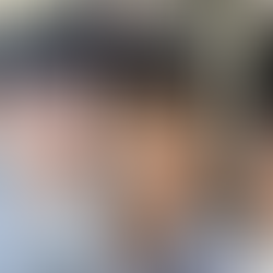 อัพเกรดความหล่อ 300% "ละมุนแบบโอปป้าเกาหลี" ศัลยกรรมผู้ชายที่เกาหลี