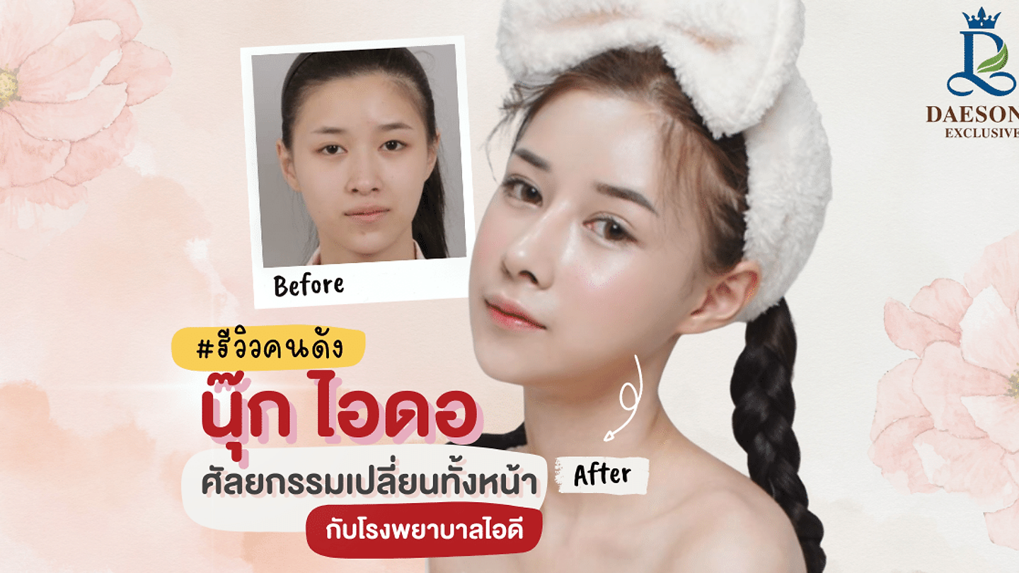 [รีวิวคนดัง]ศัลยกรรมทั้งหน้า ID HOSPITAL (ตอนที่ 1)