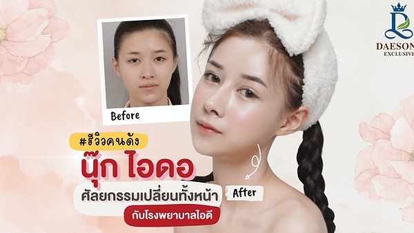 [รีวิวคนดัง]ศัลยกรรมทั้งหน้า ID HOSPITAL (ตอนที่ 1)