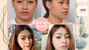 PROMOTION สุด Hot 🔥 by banobagi