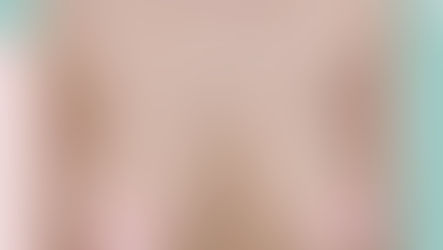 รีวิวหน้าอก จากลูกค้าจริง จาก รพ.ID แบบปังๆค่าา