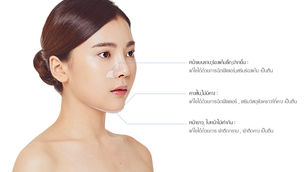 ศัลยกรรมขากรรไกรแบบมินิ ด้วยวิธีการแบบผสมผสาน Banobagi