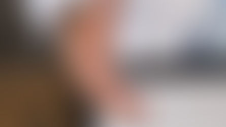 การเตรียมตัวก่อนเสริมจมูก และการเตรียมตัวในวันที่ผ่าตัด