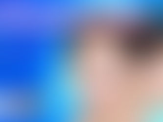 เสริมจมูกแบบปิด โดยเทคนิคพิเศษของ Dream