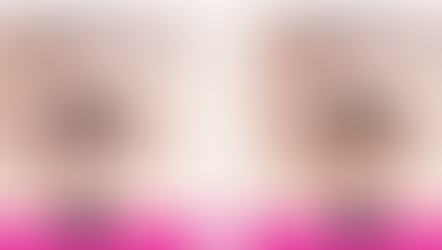 ศัลยกรรมตาสำหรับ ‘วัยกลางคน’ PART 02