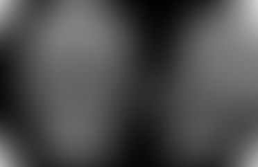 เสริมจมูกอย่างธรรมชาติด้วย 3D-CT