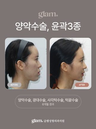 รีวิว Glam Plastic Surgery โรงพยาบาลผ่าตัดขากรรไกรและโครงหน้าเฉพาะทาง