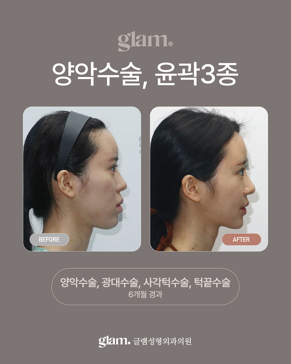 รีวิว Glam Plastic Surgery โรงพยาบาลผ่าตัดขากรรไกรและโครงหน้าเฉพาะทาง