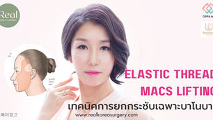 Banobagi กับเทคโนโลยีการยกกระชับด้วย Elastic thread MACS Lifting