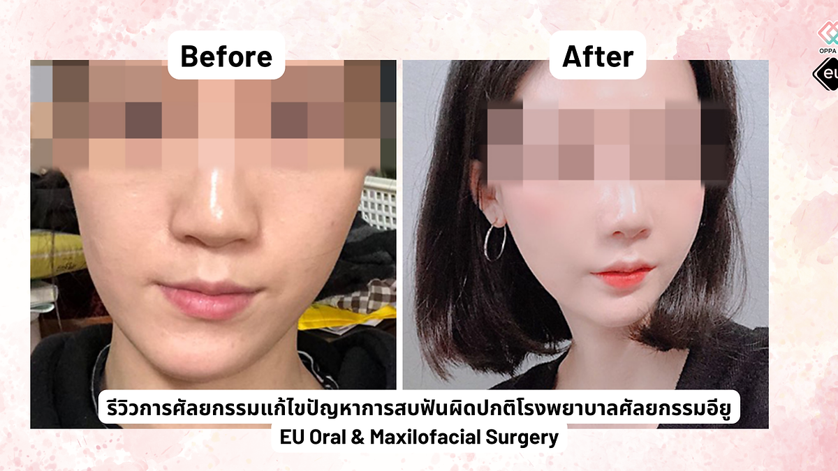 Cover image for the Korean plastic surgery hospitals section