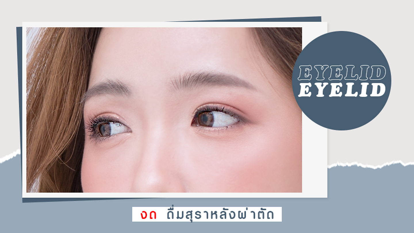 งดสุราหลังศัลยกรรมตา สามารถดื่มได้อีกครั้งเมื่อไหร่? (ตอนที่ 2)