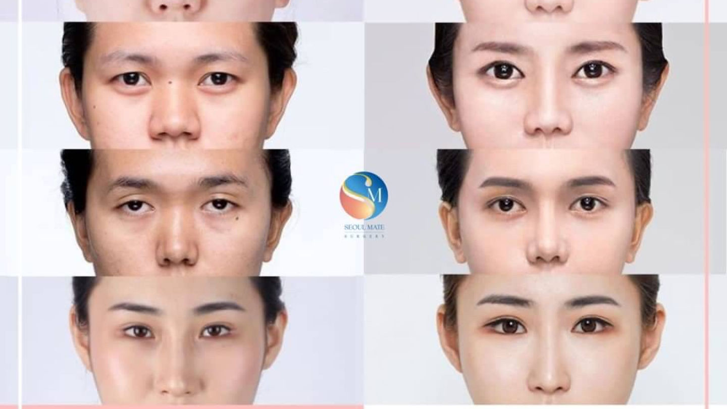 หน้าต่างเราสวย หัวใจเราก็สดใสค่ะ (ตอนที่ 1)