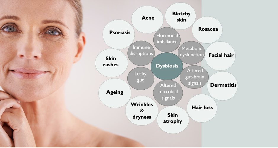 dysbiosis